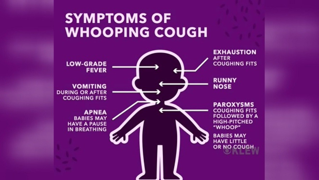 What is whooping cough? Symptoms parents should look for as cases rise ...